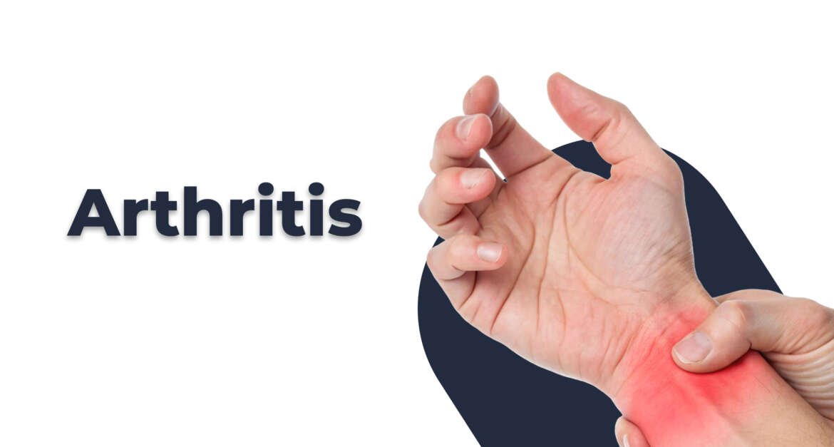 Arthritis